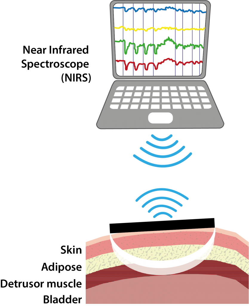 NIRS diagram