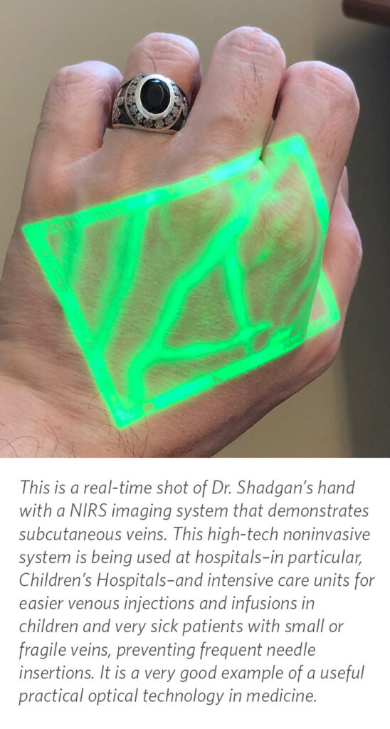 This is a real-time shot of Dr. Shadgan's hand with a NIRS system that demonstrates subcutaneous veins.